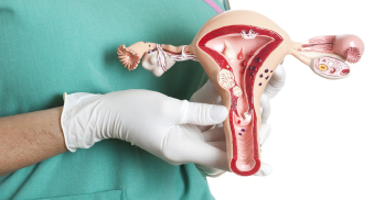 Hysterectomy